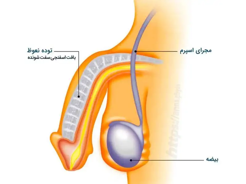 درمان اختلالات نعوظ